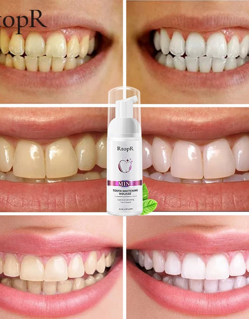 Load image into Gallery viewer, RtopR Teeth Cleansing Whitening Mousse Removes Stains Teeth Whitening
