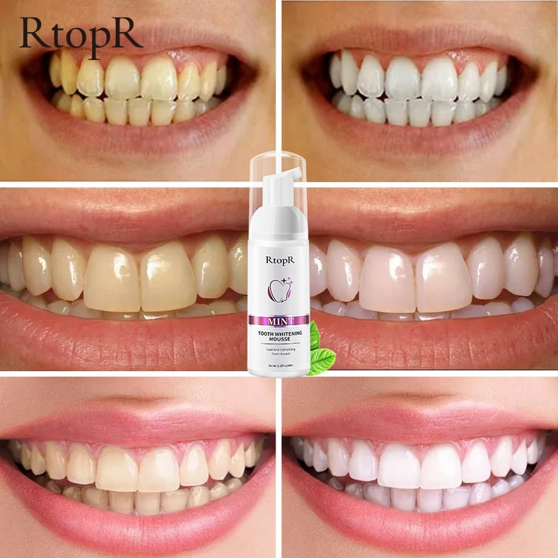 RtopR Teeth Cleansing Whitening Mousse Removes Stains Teeth Whitening