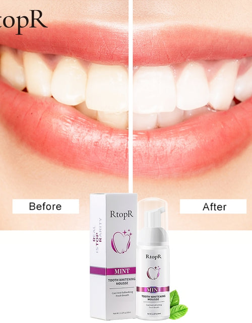 Load image into Gallery viewer, RtopR Teeth Cleansing Whitening Mousse Removes Stains Teeth Whitening
