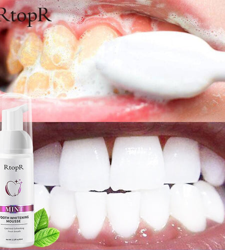 RtopR Teeth Cleansing Whitening Mousse Removes Stains Teeth Whitening
