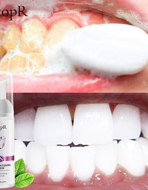 Load image into Gallery viewer, RtopR Teeth Cleansing Whitening Mousse Removes Stains Teeth Whitening
