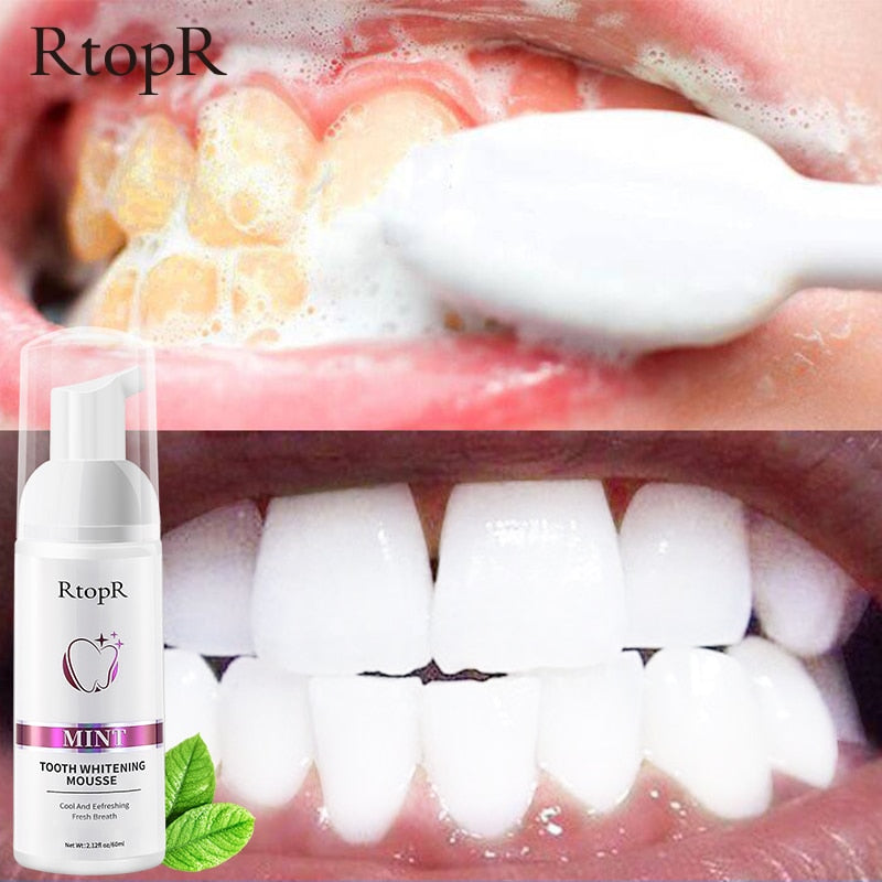 RtopR Teeth Cleansing Whitening Mousse Removes Stains Teeth Whitening